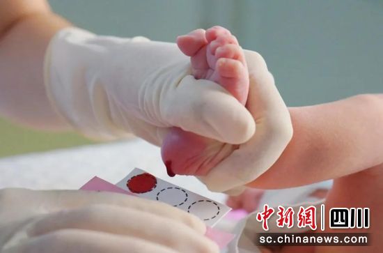 新生兒取足跟血接受篩查。成都市婦女兒童中心醫(yī)院供圖