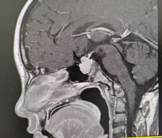  СԬg(sh)ǰBXMRIƬɶеt(y)Ժ D