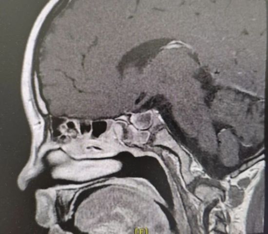 СԬg(sh)(f)BXMRIƬɶеt(y)Ժ D